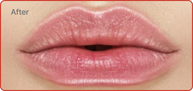 rejouir_kiss